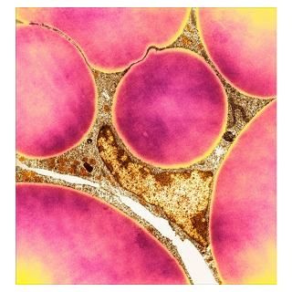 Wall Art > Posters > Fat cells, TEM Poster
