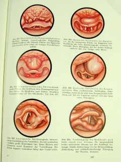 WWII German Medical Book Atlas Ear Nose Throat Diseases