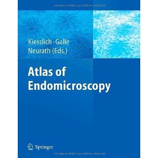 Atlas of Endomicroscopy eBook Ralf Kiesslich, Peter R. Galle, Markus