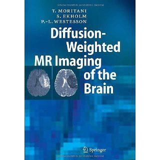 Diffusion Weighted MR Imaging of the Brain T. Moritani